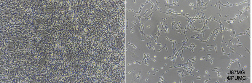 ATCC CCL-228 U-87 MG细胞图片